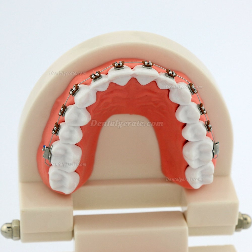 Dental Teach Typodont Demonstrationszahnmodell mit Zahnspangen F&uuml;r die Patientenstudie 5006